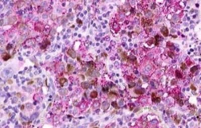 Immunohistochemistry: GPR12 Antibody [NBP3-14346]